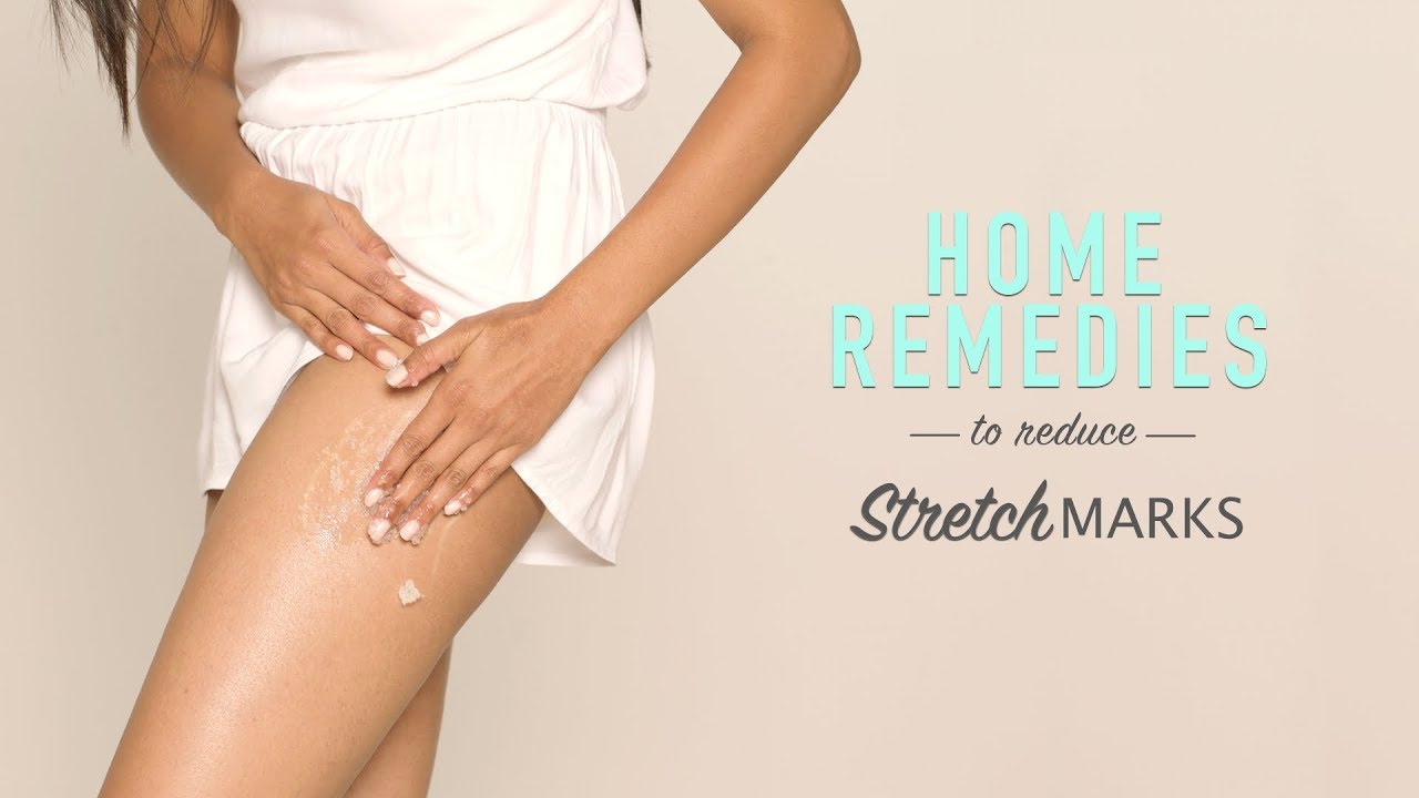 How To Reduce Stretch Marks | DIY Home Remedies