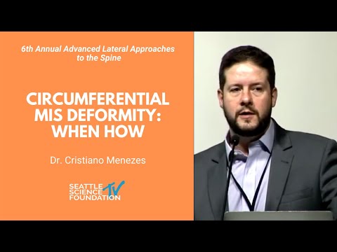 Circumferential MIS Deformity: When How - Cristiano Menezes, MD, PhD
