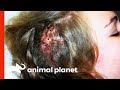 Doctor Extracts 212 Living Larvae From Girl's Head | Monsters Inside Me