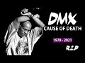 How Did DMX Die? Cause of Death Revealed