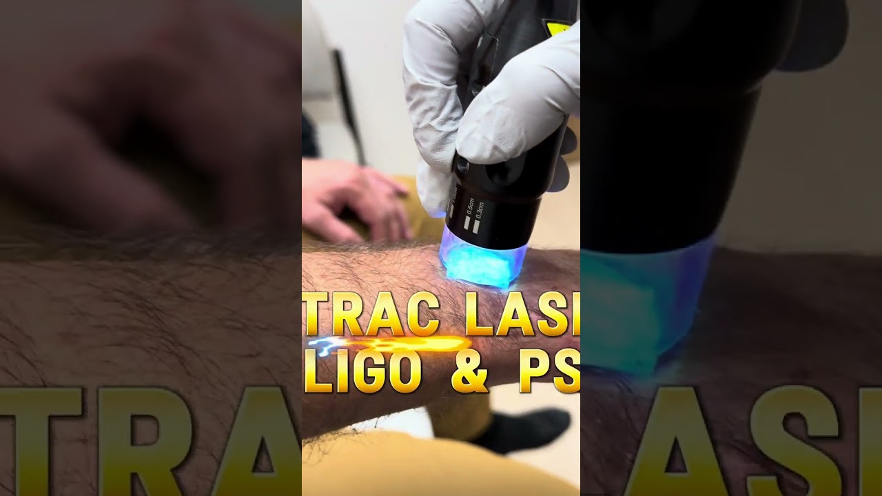 XTRAC Laser for Vitiligo and Psoriasis | Spectrum Dermatology of Atlanta | Roswell, Cumming, GA