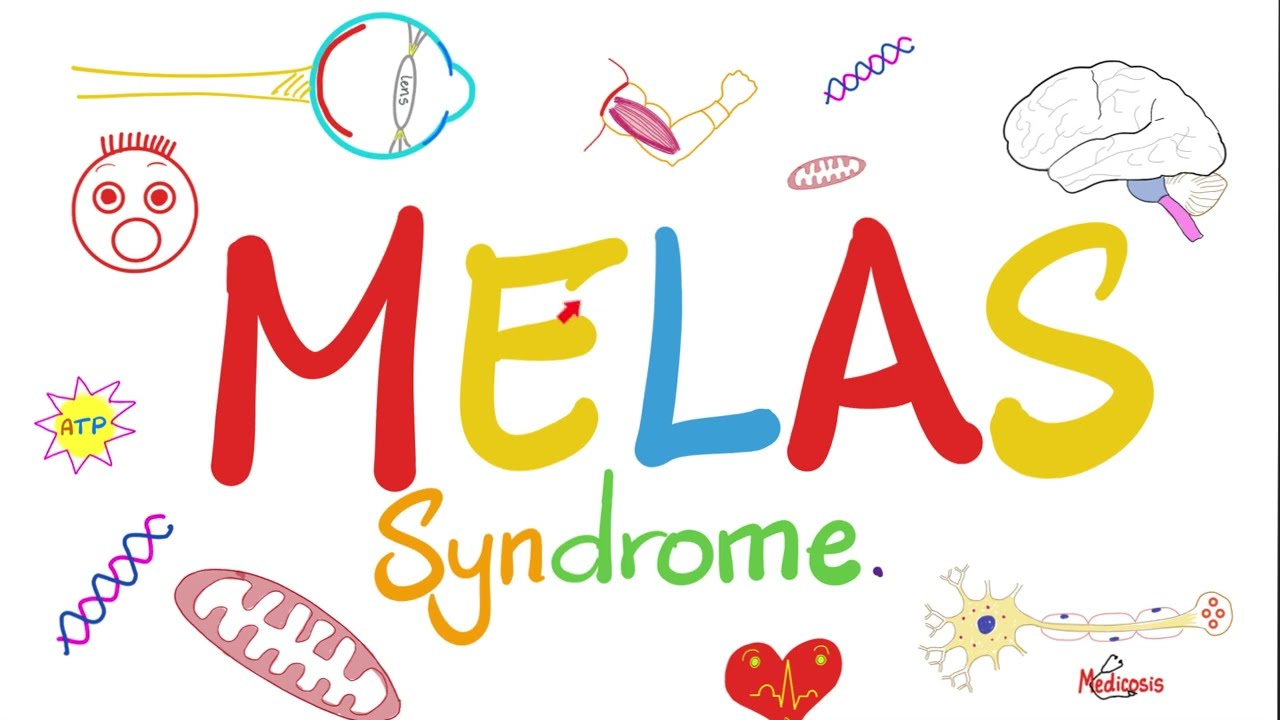 Mitochondrial Disease - MELAS Syndrome - Mitochondrial Encephalopathy with Lactic Acidosis & Stroke