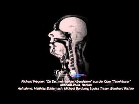 Look inside the head of a opera singer as he performs Wagner Live As He Performs