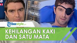 Jurnalis Fox News Alami Nasib Tragis, Rela Kehilangan Mata dan Kaki saat Meliput Invasi ke Ukraina