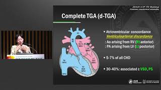 2019 서울아산병원 산부인과 30주년 기념 심포지움 - 제 9회 태아치료센터 워크샵 : Common conotruncal anomalies 미리보기