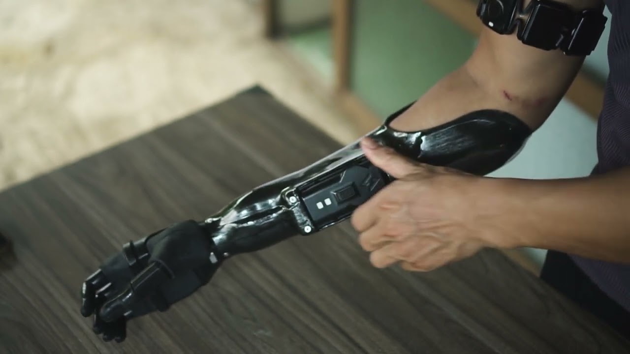 How to use Vulcan Myoelectric Hand | Fitting