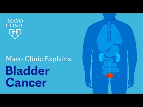 Mayo Clinic Explains Bladder Cancer