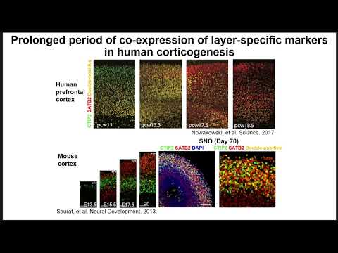 KGRI Lecture Series - Engineering human brain organoids for modeling brain development and injury