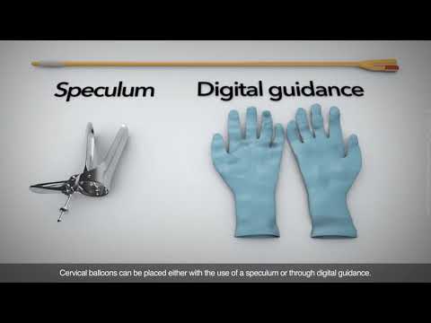 Techniques for induction of labour