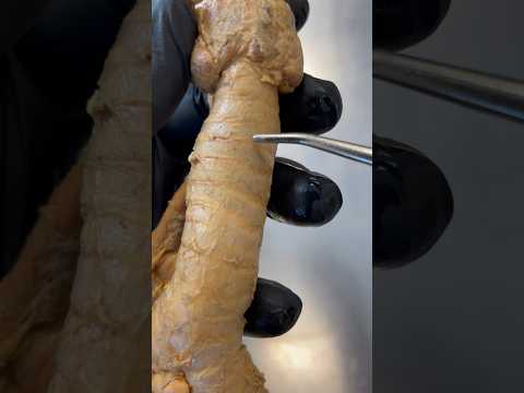 What Keeps Your Airway From Collapsing? Real Human Trachea