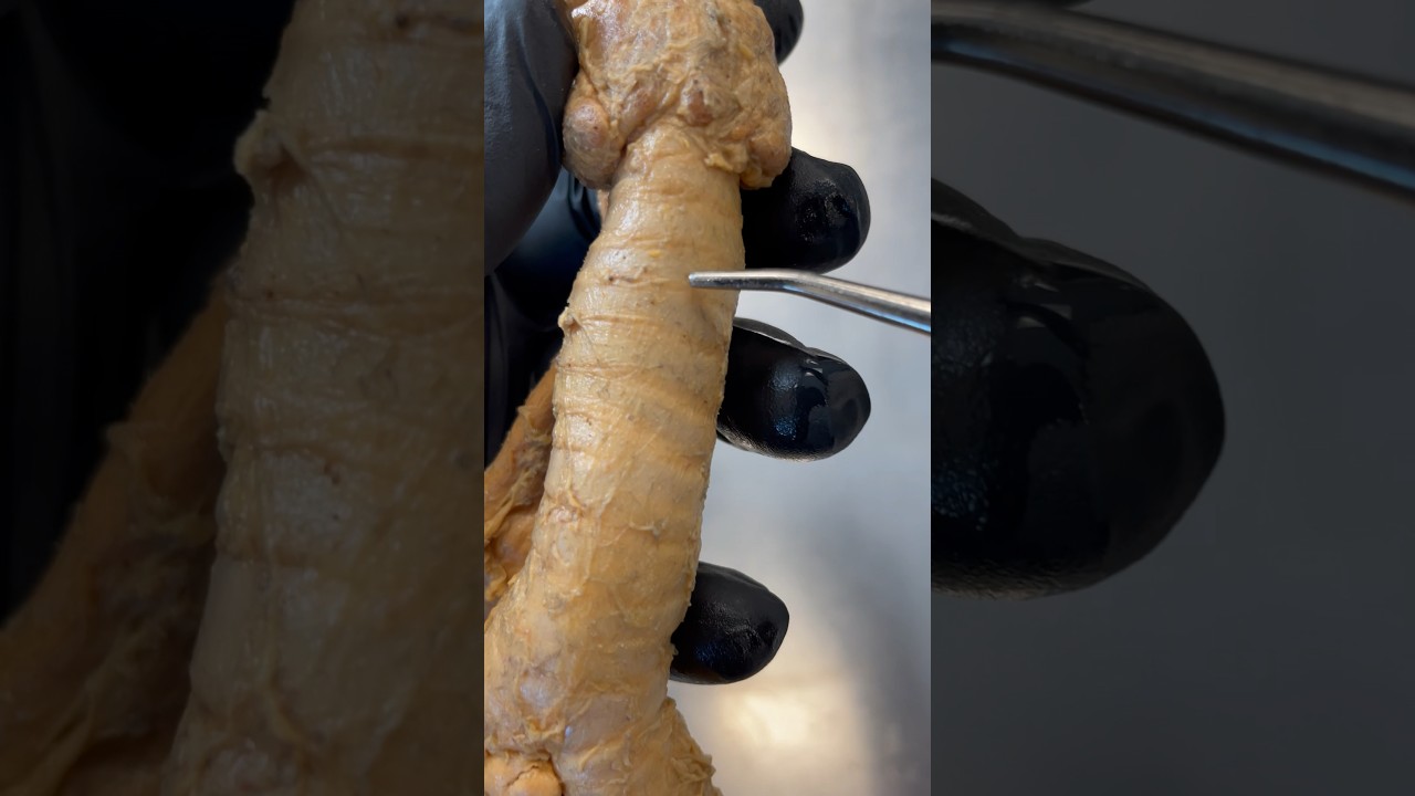 What Keeps Your Airway From Collapsing? Real Human Trachea