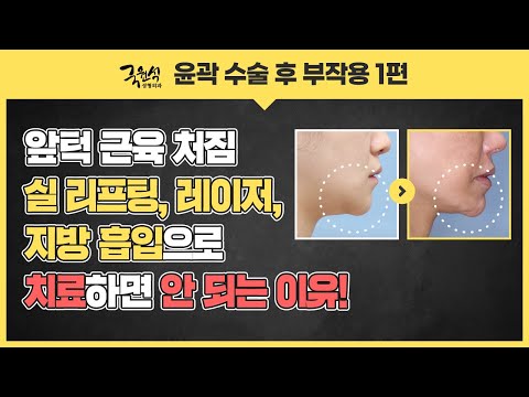 윤곽 수술 부작용! 아직도 리프팅과 레이저로 해결하려고 하셨나요?