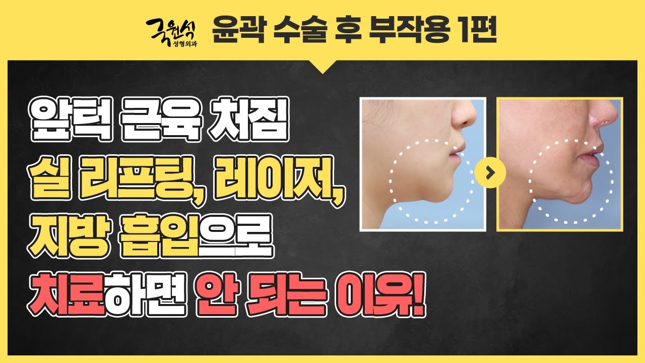 윤곽 수술 부작용! 아직도 리프팅과 레이저로 해결하려고 하셨나요? 썸네일