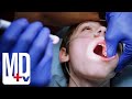 Poor Oral Hygiene Ends in Brain Infection | Chicago Med | MD TV