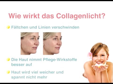 Video prima die Schuppenflechte Videos zu leben Die Schuppenflechte des Kopfes limfousel