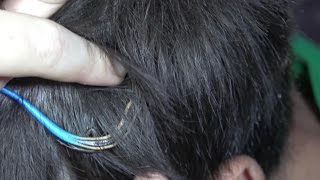 4K Scary Skinks In My Scalp: Brain Burrowers. Fun Travel Nature Herping Fishing.