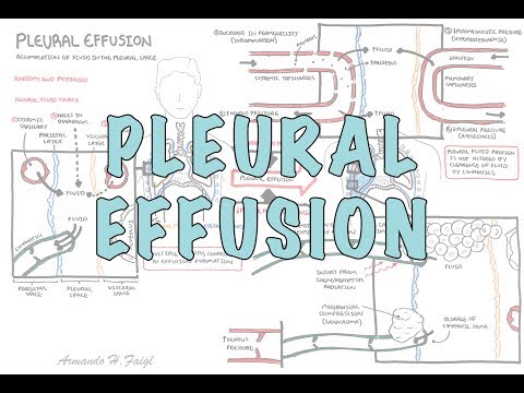 Pleural Effusion (DETAILED) - (pathophysiology, signs and symptoms, treatment)
