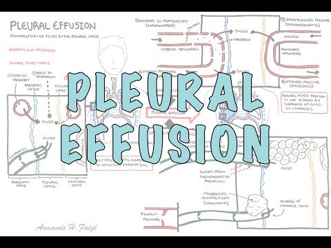 Pleural Effusion (DETAILED) - Overview