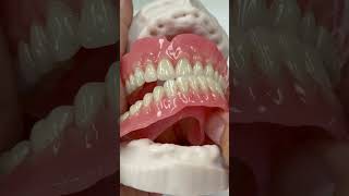Immediate dentures!