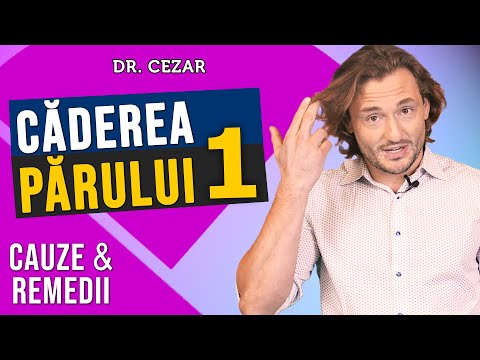 varicoza i pierdere de par