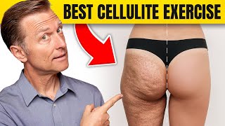 The best cellulite exercise - Dr. Berg