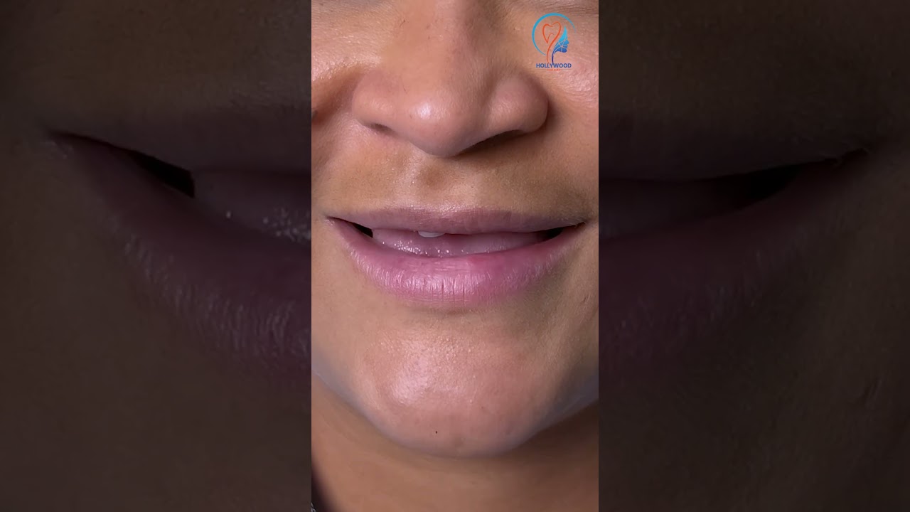 video 9