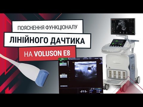 4D конвексний датчик до GE Voluson E8 – навчання - Статті RH