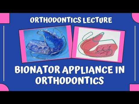 Bionator Appliance In Orthodontics | Dr Manase