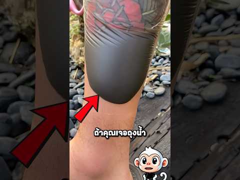 ถุงน้ำบนรอยสักคืออะไร? #สาระ #viral #shorts