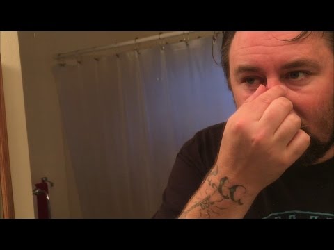 TDW 1421 - Did I Break My Nose ?