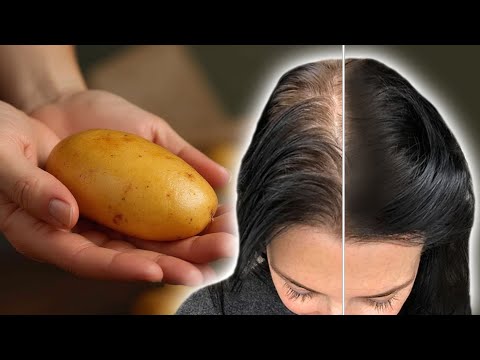 Hair grows like crazy and does not fall out! the most effective recipe!