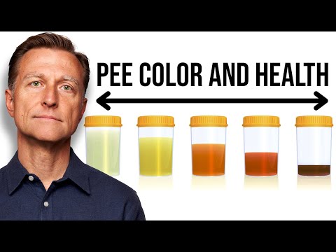 What Your URINE COLOR Says about Your Health