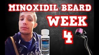 Minoxidil Beard | Week 4 | The Experiment |  #Facialfuzzfridays