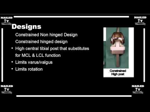 Introduction to total knee arthroplasty with NailedItOrtho Podcast: Dr. Matthew Harb