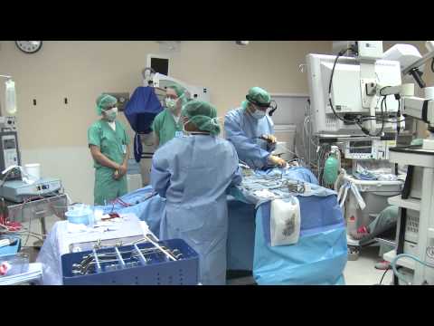 Full Videos Surgery: Deviated Septum Nose Surgery . Sinus Surgery .