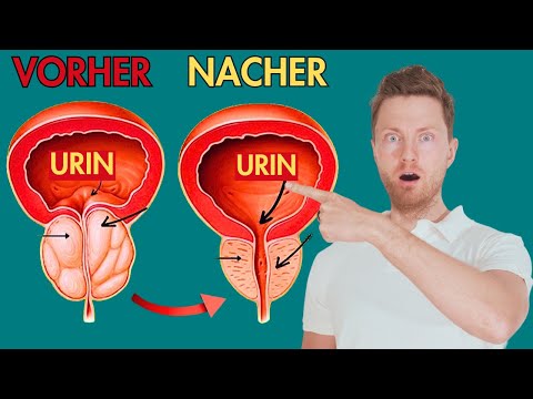 PELVIC FLOOR TRAINING FOR MEN 💪: The 4 MOST EFFECTIVE EXERCISES for a HEALTHY PROSTATE!