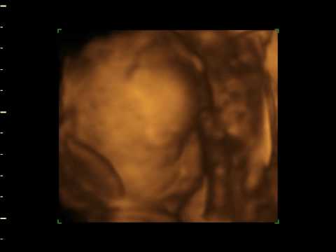 MICAH ALLANA 27 WEEKS 4D9