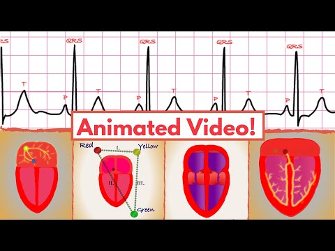 Sinus Rhythm (5 simple steps for interpretation on an ECG/EKG)!