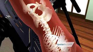 How an Inversion Table Decompresses Your Spine