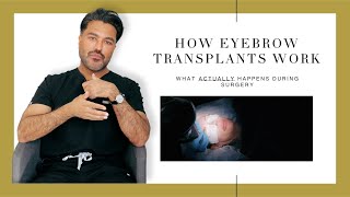 Canadian Hair Transplant Centre