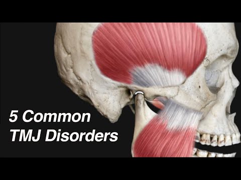 5 Common TMJ Disorders (Causing Ear Pain, Jaw Pain, Lockjaw, and/or Clicking/Popping)