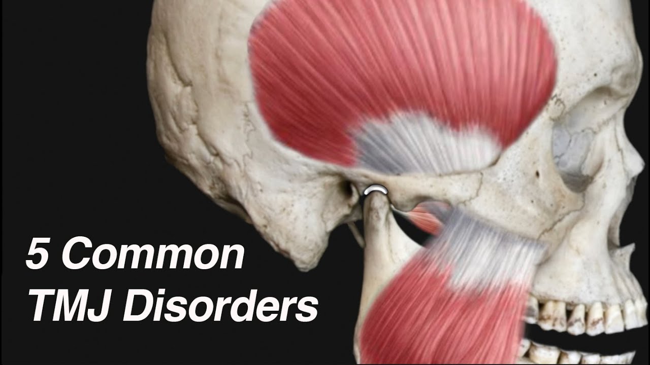 5 Common TMJ Disorders (Causing Ear Pain, Jaw Pain, Lockjaw, and/or Clicking/Popping)