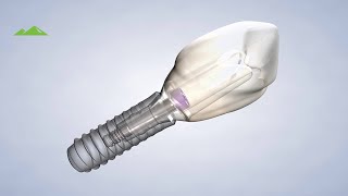 preview picture of video 'Post Operative Instructions: Dental Implant Procedure - Utah Surgical Arts | Provo UT'