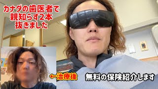 【カナダ生活】親知らずの治療費は？経過は？保険は？全部お伝えします