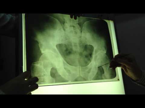 Рентген таза
