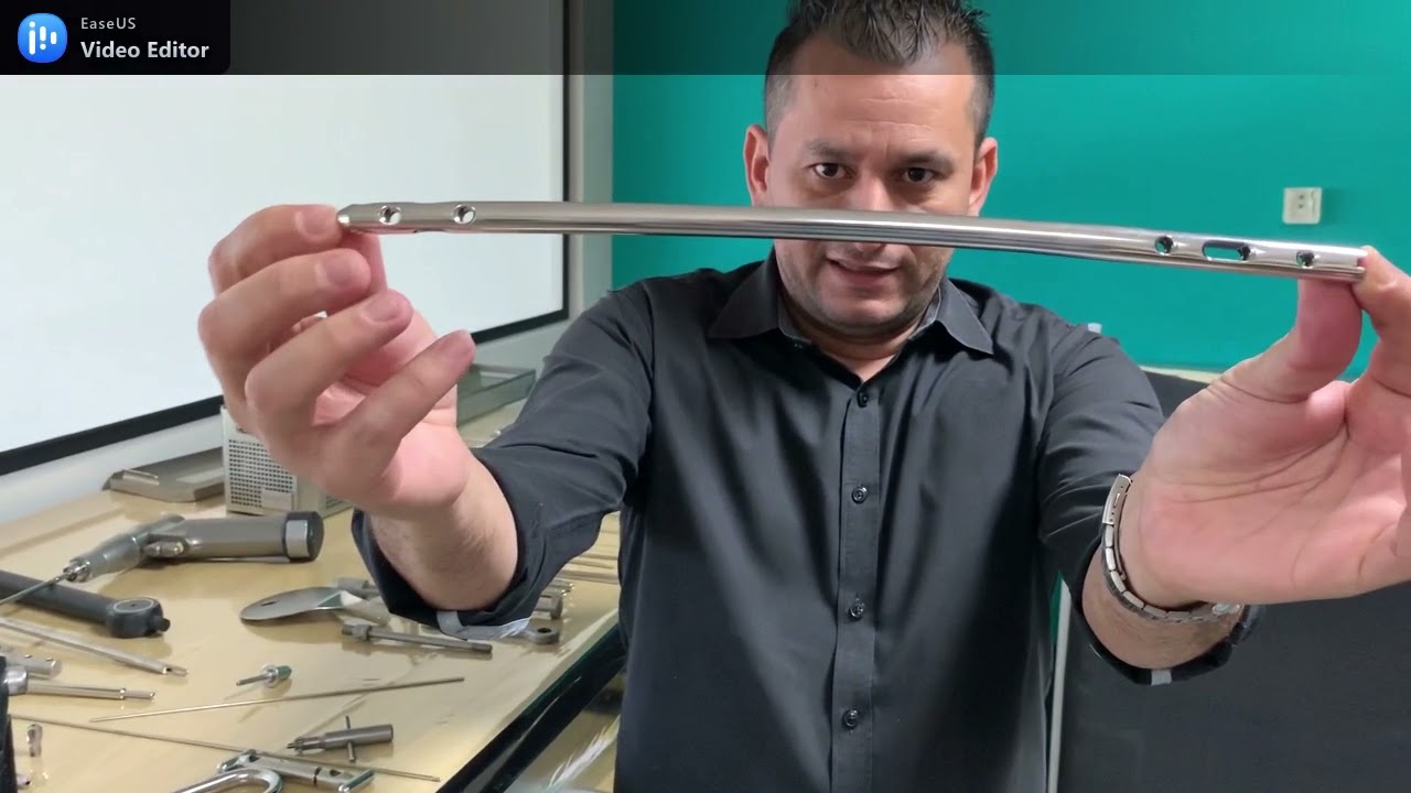 TÉCNICA CIRÚRGICA DA HASTE INTRAMEDULAR DE FEMUR