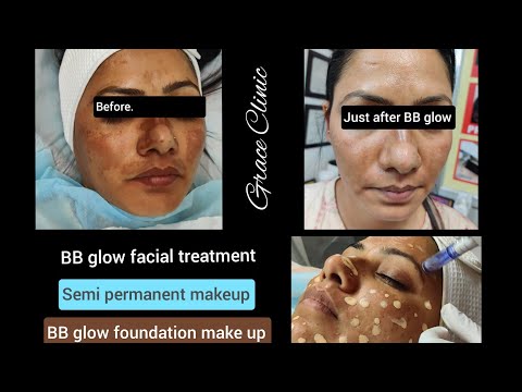 Grace Clinic video