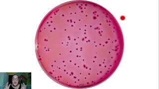 Análises microbiológicas de coliformes e Escherichia coli (1/2)