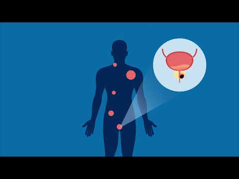 Abiraterone acetate abitate 250 mg, grade standard: medicine...