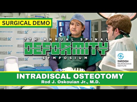SURGICAL DEMO - Intra-discal Osteotomy (IDO) - Rod J. Oskouian Jr , M.D.